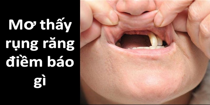 Giải Mã Nằm Mơ Thấy Rụng Răng Điềm Báo Lành Hay Dữ